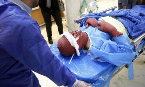 چهارشنبه‌سوری تا الان ۶ فوتی و ۳۳۱ مصدوم دارد