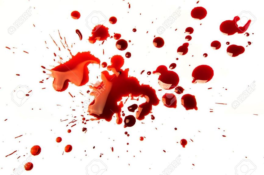 معلم خشمگین شاگردش را سوزاند