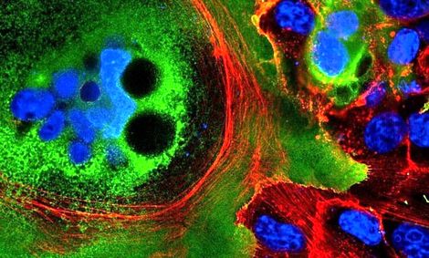 شناسایی ۵ تبعه هندی کرونا مثبت در بوشهر