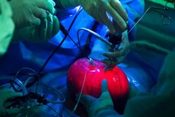 انجام جراحی نادر جنین در رحم، خارج از بدن مادر