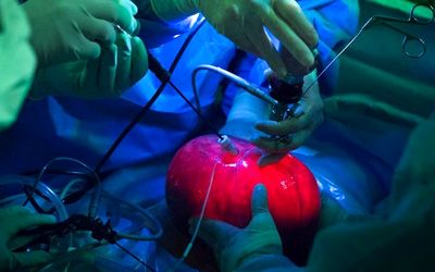 انجام جراحی نادر جنین در رحم، خارج از بدن مادر