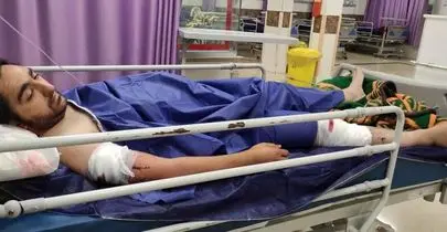 زورگیری خونین از یک عکاس خبری در تهران | ۲۱ ضربه چاقو زدند، لنز و لپ‌تاپ و دوربین را بردند