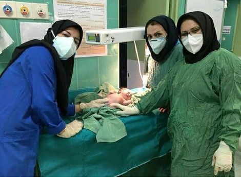 تولد اولین نوزاد سالم از مادر کرونایی در قزوین