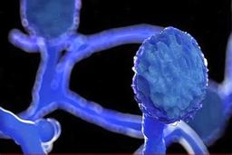 آخرین وضعیت بروز قارچ سیاه در بیماران کرونا