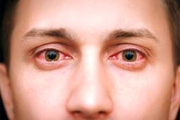 قارچ سیاه، یک عفونت قارچی جدی