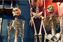 فروش استخوان انسان!