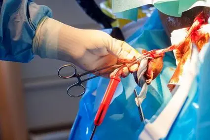 بند ناف طلای سرخ