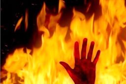 مردی که همسر سابقش را آتش زد!