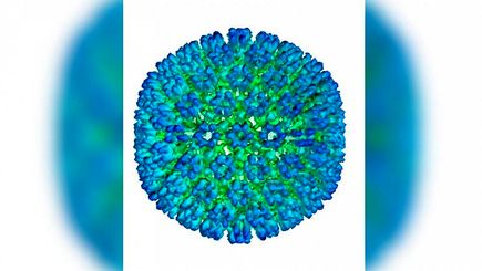 عامل بیماری (ام اس) ویروس!