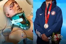 مدال المپیک، پس از سه روز کما!