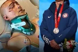 مدال المپیک، پس از سه روز کما!