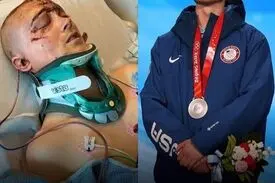 مدال المپیک، پس از سه روز کما!