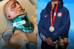 مدال المپیک، پس از سه روز کما!