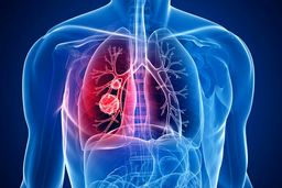 توصیه‌های یک متخصص ریه درباره مواد شوینده و آلرژی‌های فصل بهار