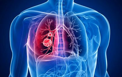 توصیه‌های یک متخصص ریه درباره مواد شوینده و آلرژی‌های فصل بهار