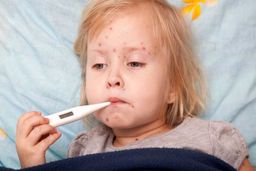 ابتلای ۹۶ نفر به سرخک در کشور