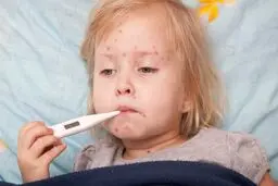 ابتلای ۹۶ نفر به سرخک در کشور