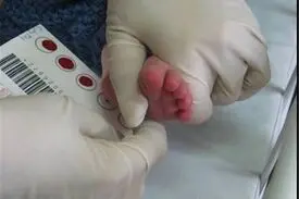 جزئیات غربالگری کم‌کاری تیروئید در نوزادان