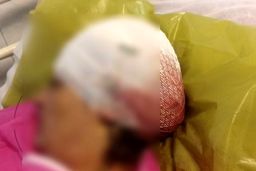 حمله با داس به ۲شهروند درکلاردشت توسط رئیس بنیادشهید