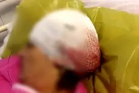 حمله با داس به ۲شهروند درکلاردشت توسط رئیس بنیادشهید