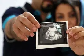 توضیحات وزارت بهداشت درباره ساماندهی غربالگری سندروم داون