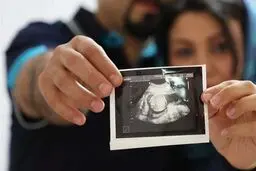 توضیحات وزارت بهداشت درباره ساماندهی غربالگری سندروم داون