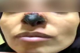 عمل های زیبایی، نابود کننده زیبایی!