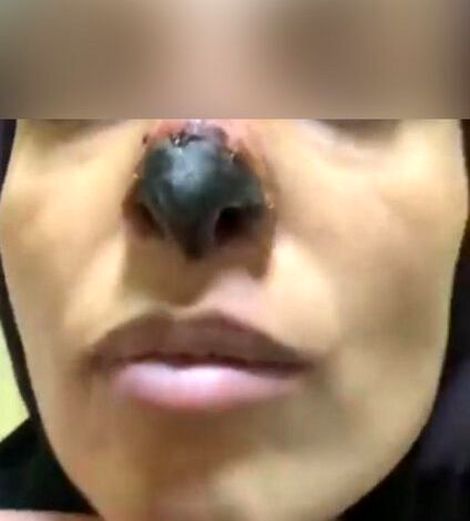 عمل های زیبایی، نابود کننده زیبایی!