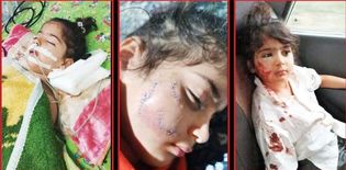 حمله سگ به دوقلوها، جان یکی از آنها را گرفت / تکرار تراژدی کودک‌کشی سگ‌ هار