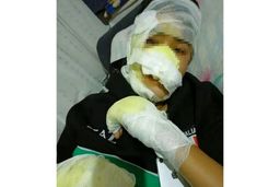 نوجوانان ترکیه‌ای دوست خود را درون تنور انداختند