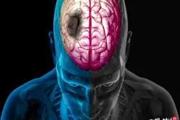 مقایسه علایم و نشانه های سکته قلبی و مغزی