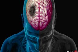 مقایسه علایم و نشانه های سکته قلبی و مغزی