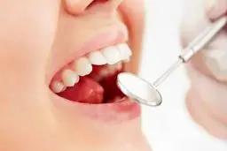 ۵ درمان خانگی برای پوسیدگی دندان‌