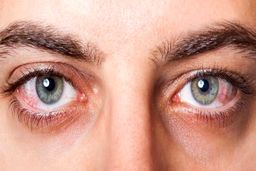 همه چیز درباره «آب مروارید» و راه‌های درمان آن