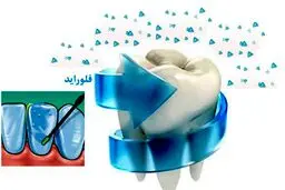 آیا سرطان‌زا بودن «فلوراید» باوری غلط است؟