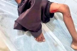 حمله مجدد گاندوها به یک‌کودک در چابهار