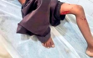 حمله مجدد گاندوها به یک‌کودک در چابهار