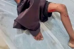 حمله مجدد گاندوها به یک‌کودک در چابهار