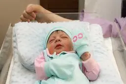 ۶ عارضه مهم سزارینِ انتخابی