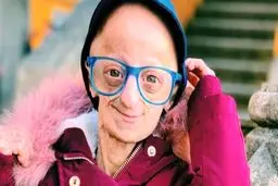 بیماری وحشتناکی که دختر پرتغالی را در جوانی پیر کرده است! + تصاویر