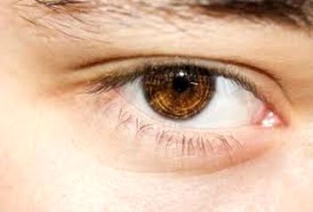 پُف صبحگاهی چشم‌ها چطور رفع می‎‌شود؟