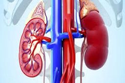 کلیه چه کسانی سنگ‌ساز است؟