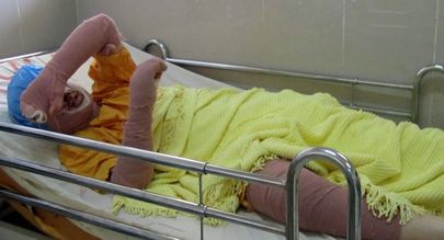 اظهارات عجیب پدر دختر آزادی که خودسوزی کرد! / او حالش بد است !