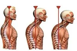 ناهنجاری‌های بدنی در بین مردم بیشتر شده است