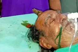 مردی که روی سرش شاخ دارد! + تصاویر