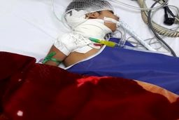 قطع نای دختربچه خرمشهری بدست سگ های ولگرد