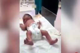 ماجرای قطع انگشت نوزاد تازه متولد شده در بیمارستان چه بود؟ + فیلم