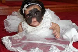 چهره عجیب و غیرمعمولی این دختربچه همه را شوکه کرد! + عکس