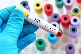 نکات حیاتی درباره ایدز که کمتر به گوشتان خورده است + راه های پیشگیری و انتقال HIV