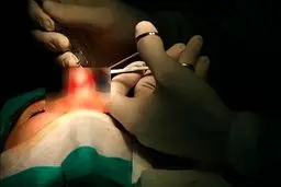 داستان تلخ دختر جوانی که بعد از جراحی بینی جان باخت